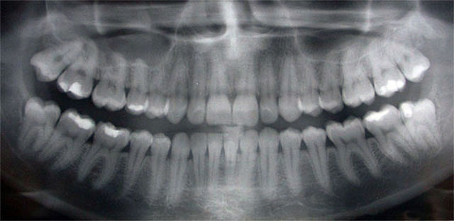 Pro Smiles Dental